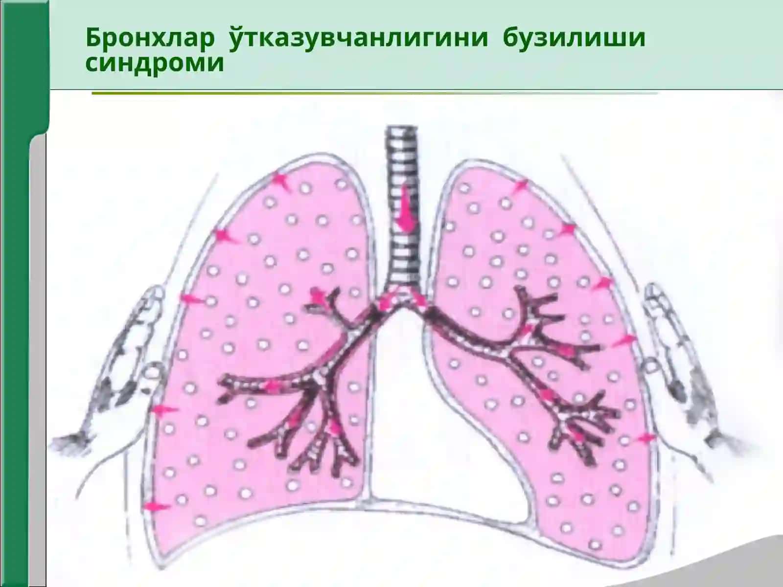 Нафас системаси касалликларидаги асосий клиник синдромлар 4