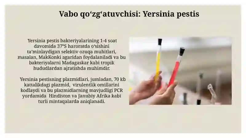 Bruselloz laboratoriya diagnostikasi usullari 4