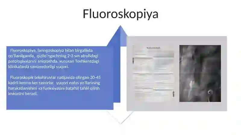 Yuqori nafas yollari kasalliklarini rentgenologik tekshirish usullari 4