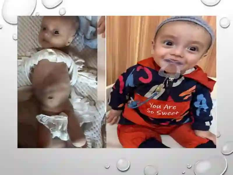 O’PKA BRONX TIZIMINING IRSIY KASALLIKLARI 4
