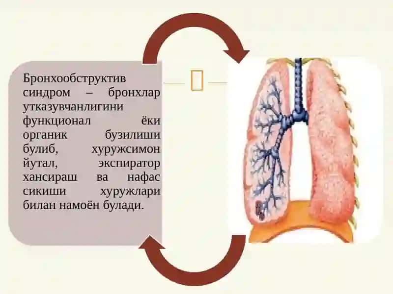 БРОНХООБСТРУКТИВ СИНДРОМ ҚИЕСИЙ ТАШХИСИ. УАШ ТАКТИКАСИ 4