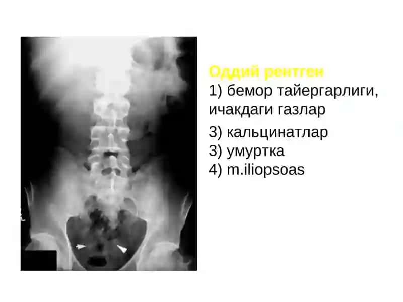 СОНОГРАФИЯ (бирламчи) 4