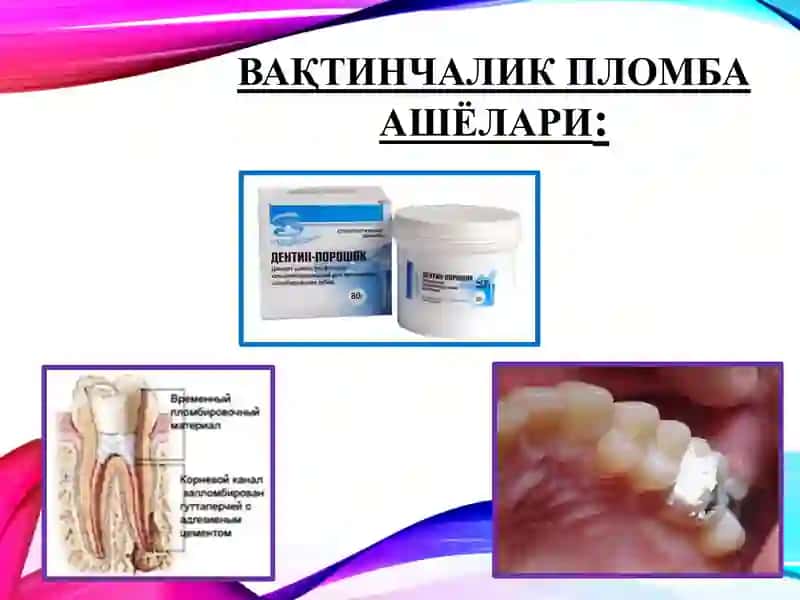 Stomatologiyada ishlatiladigan Plomba ashyolari PPTX 4