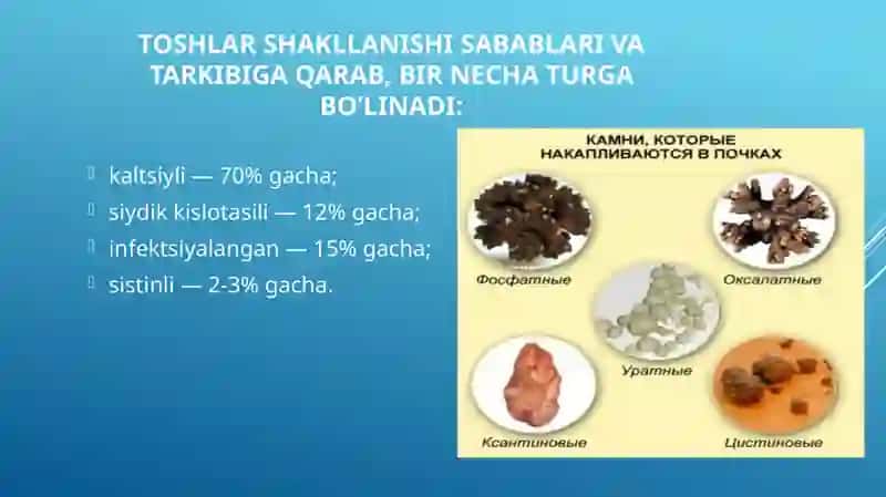 Buyraklarda Urat Toshsini Davolash 4