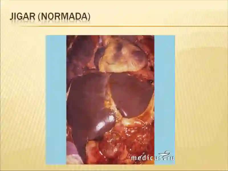 Viruslar A, B, C, D, ye 4