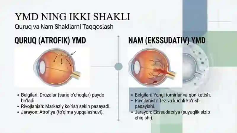 Ko’z to’r pardasidegenerativkasalliklari 4