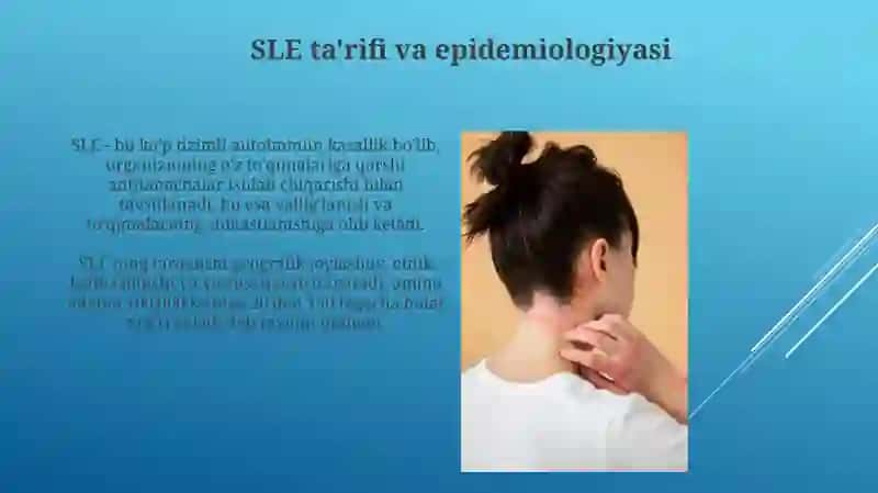 Tizimliqizilyugirik.Tizimlisklerodermiya.Dermatomiozitlar 4