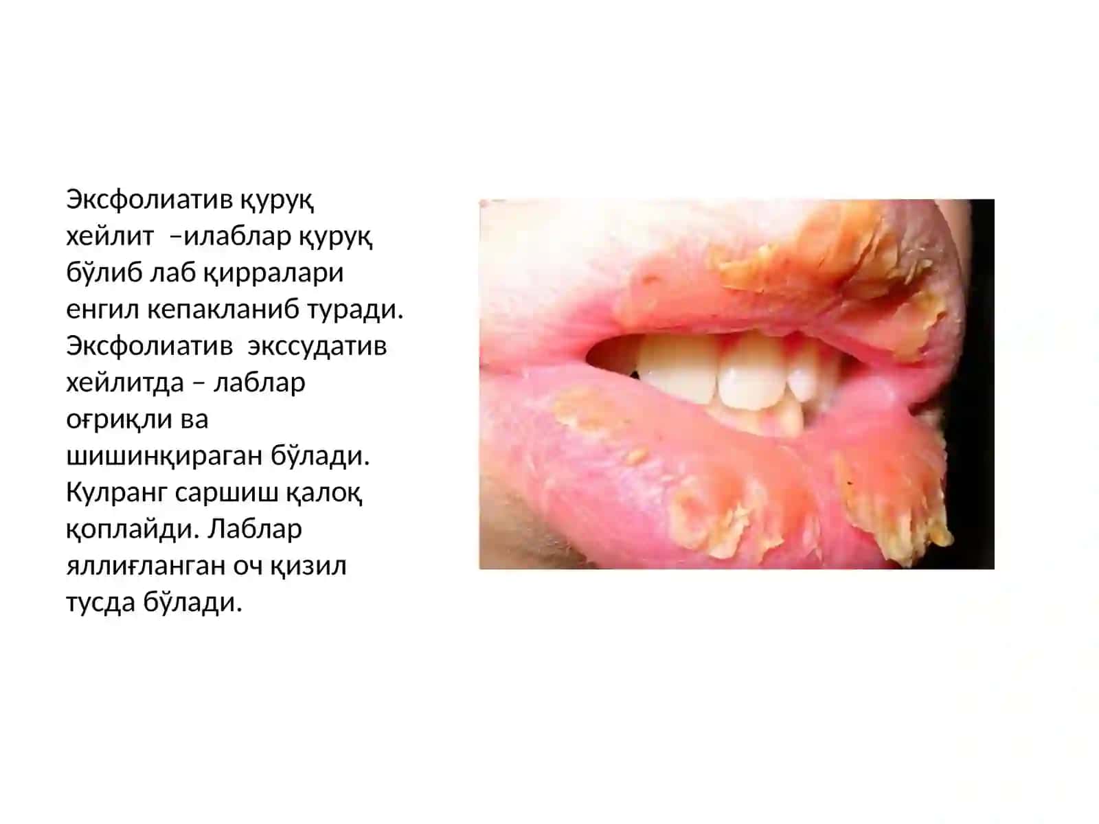 Хейлитлар 4