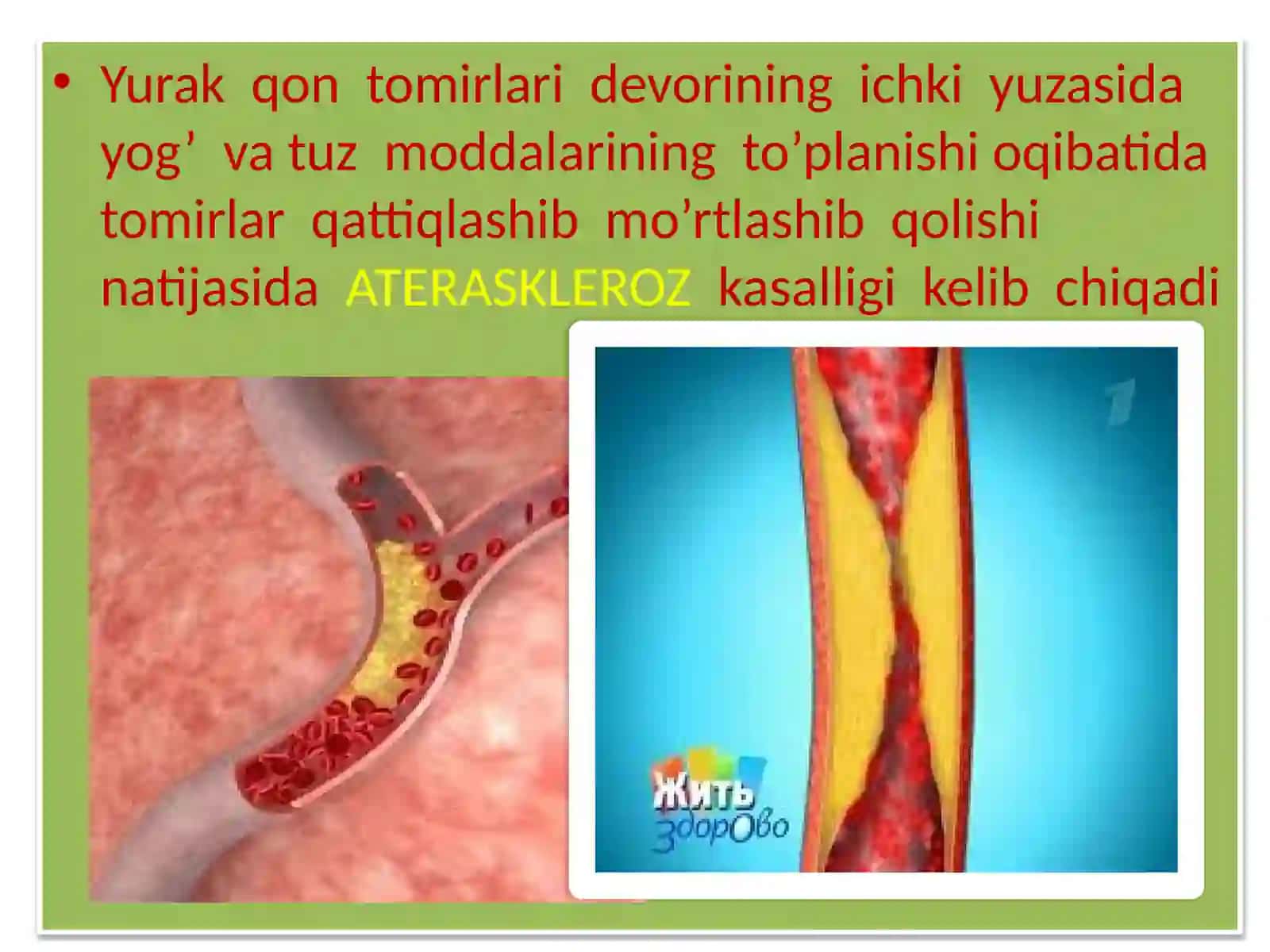 Yurak qon tomir sistemasi kasalliklari 4