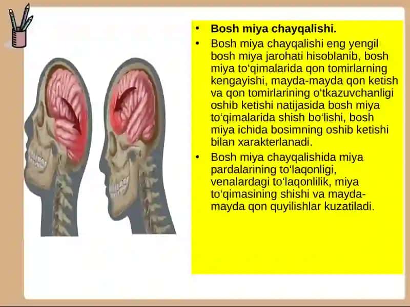 Bosh miyatravmasi 4
