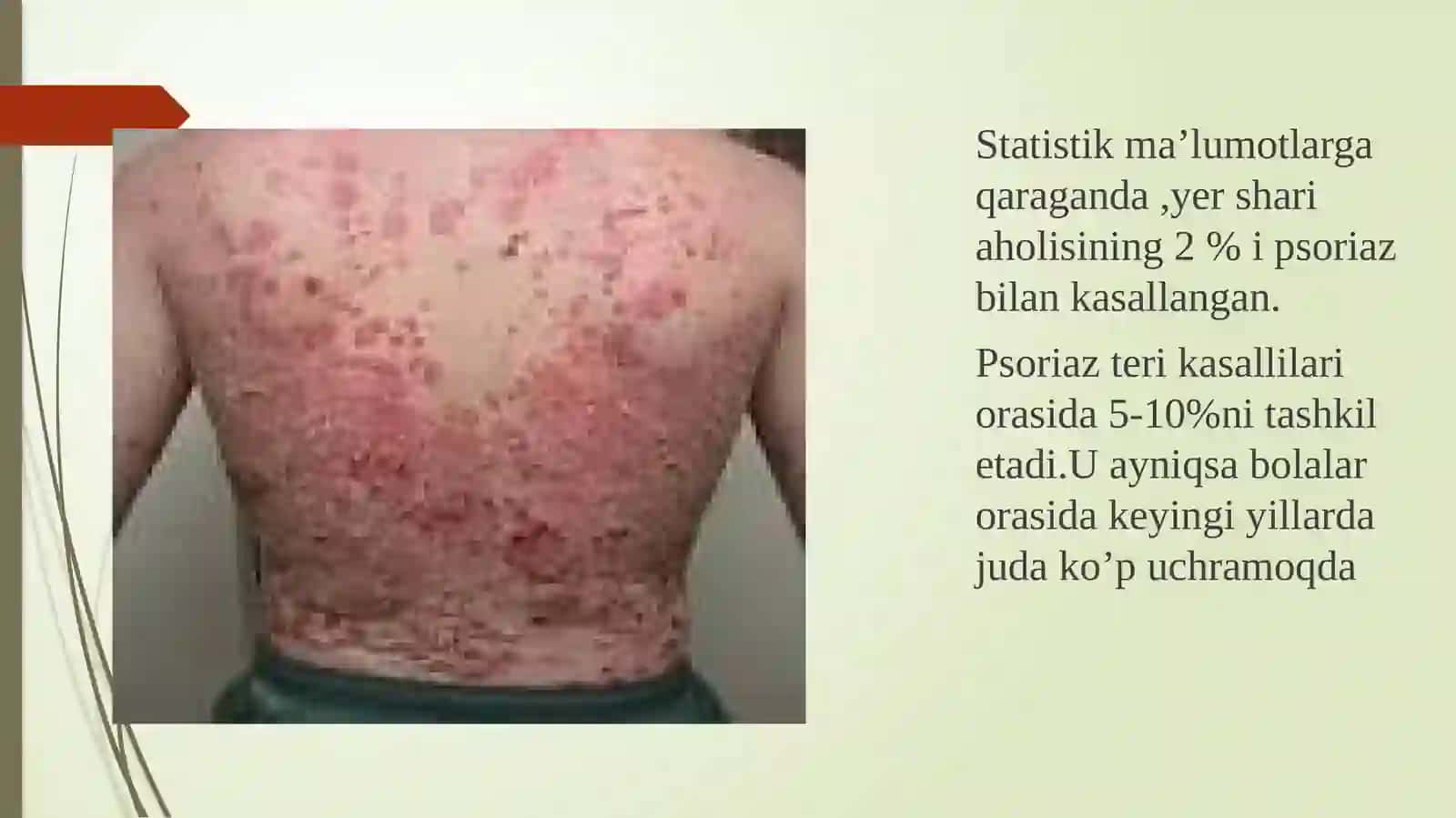Etiologiyasi yetarli aniqlanmagan teri kasalliklarida hamshiralik parvarishi 4