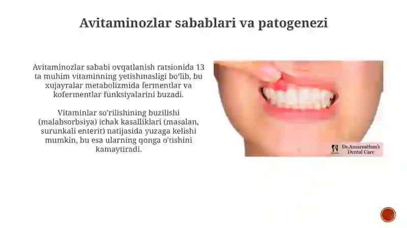 Nasliyavitaminozlar 4