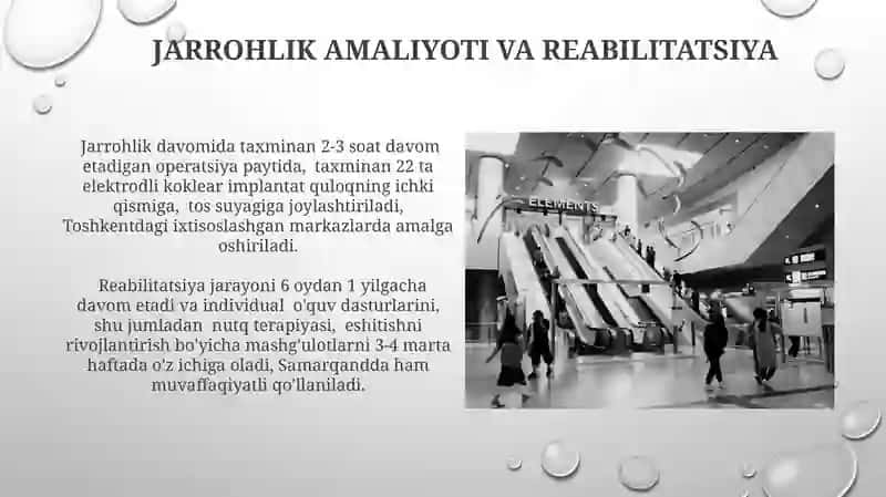 Ovoz Biofizikasi Elementlari, Koklear Implantatsiyasi Asoslari, Koklear Implantatsiyasi Jarayonlari 4