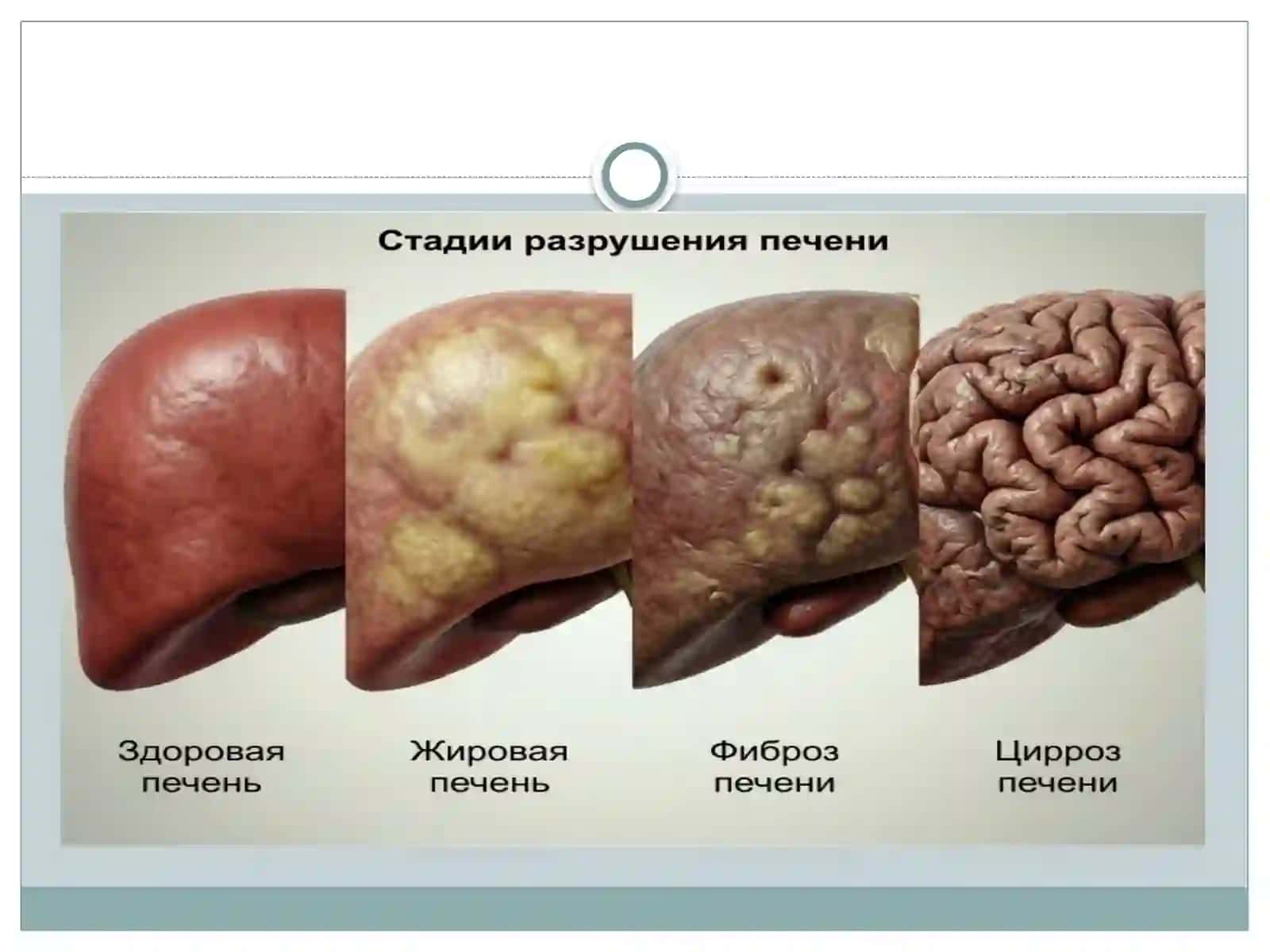 Gepatotropvao’thaydovchidorivositalariningklinikfarmakologiyasi 4
