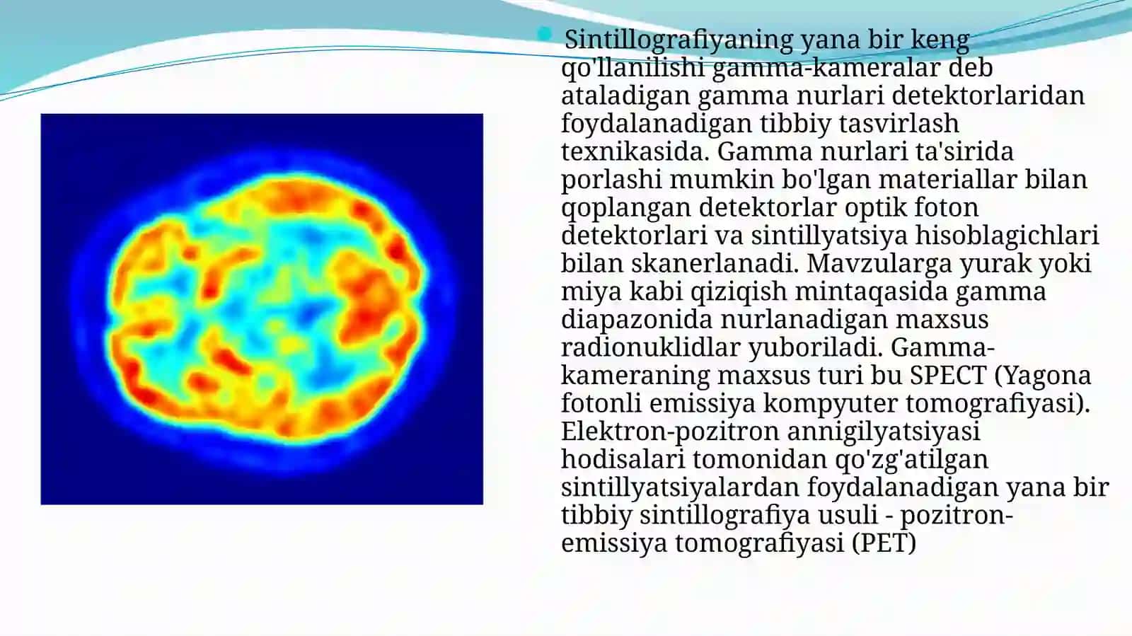 Jinsiy a’zolarni Radionuklid ssintigrafiya tekshirish usuli 4
