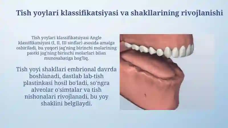 Tish yoylarining shakllari. Tish va tish yoylari 4
