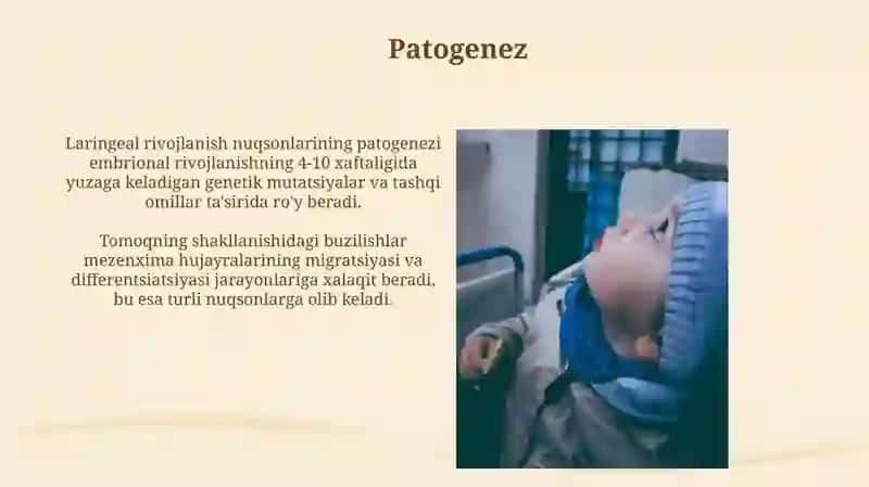 Hiqildoq rivojlanish nuqsonlari: sabablari 4
