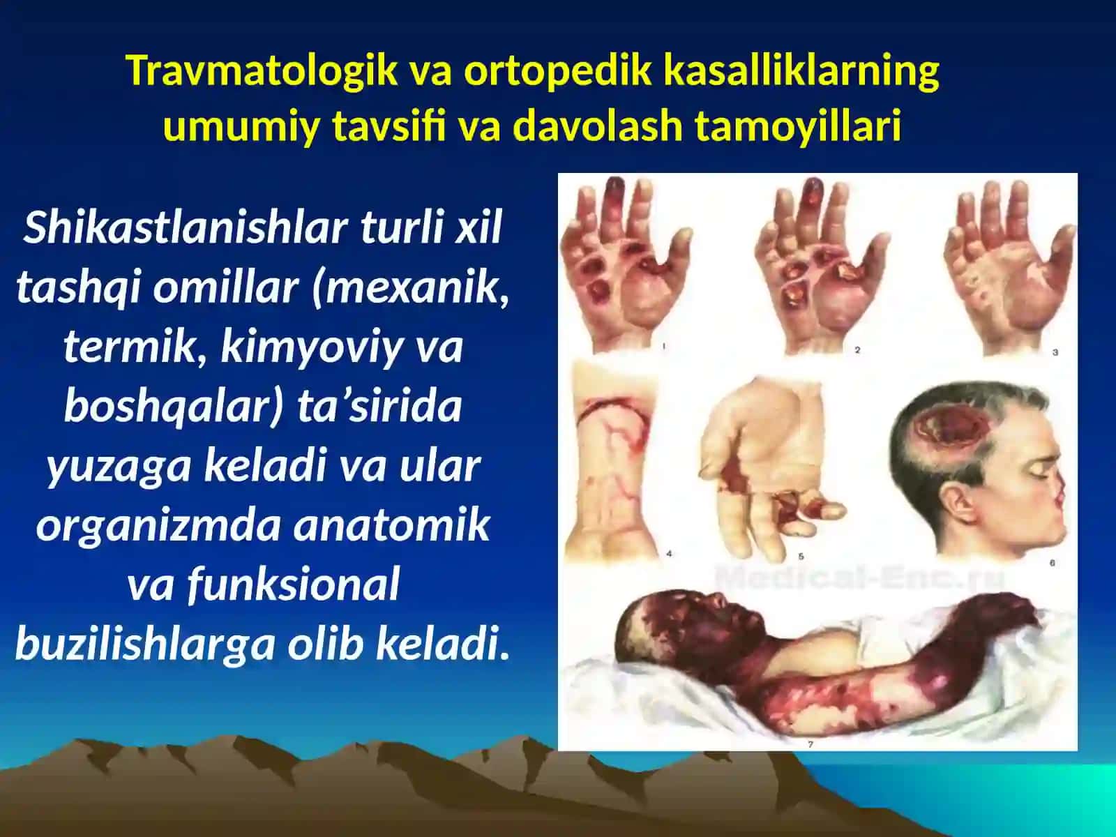 Travmatologik va ortopedik bemorlarni konservativ va operativ davolash va ularning reabilitatsiyasi 4