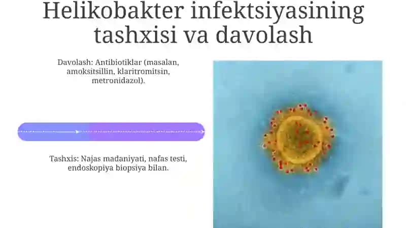 Kampilobakteriyalar xelikobakteriyalar va ularning amaliyotdagi ahamiyati 4