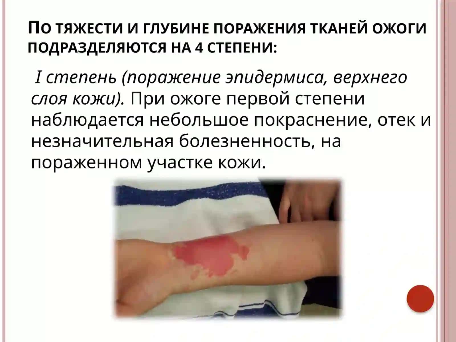 Химические ожоги: неотложная помощь 4