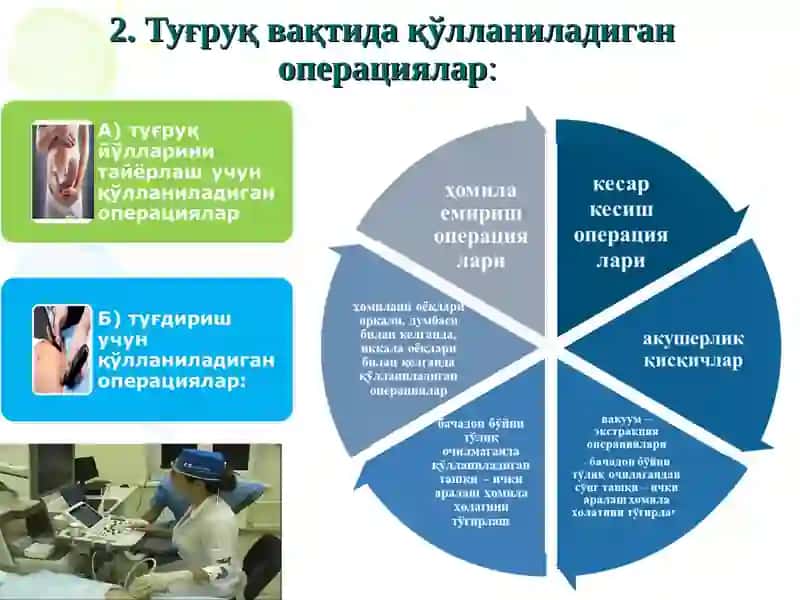 Tug’ruqni amalga oshiruvchi operastiyalar kesar kesish, akusherlik qisqichlari, vakuum ekstrakstiya. 4