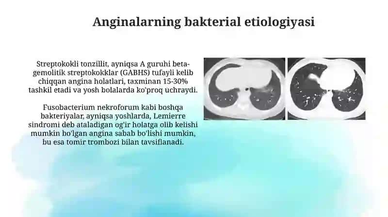 Har xil etiologiyali anginalar. Atipik pnevmoniya.Infeksiyaga bogʻliq boʻlmagan diareyalar 4