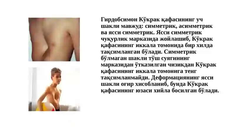 Кўкрак қафаси ва ўпканинг туғма ривожланиш нуқсонлари ва аномалиялари 4