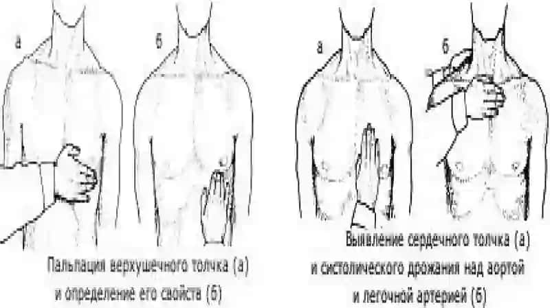 Yurak palpatiyasi, perkussiyasi, auskultatsiyasi 4