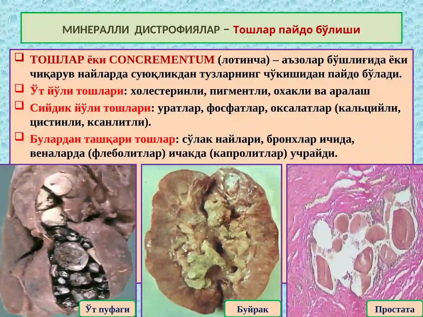 МИНЕРАЛЛИ ДИСТРОФИЯЛАР 4
