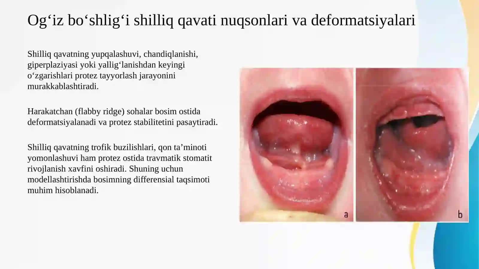 O'zbekiston Respublikasi milliy klinik davolash protokollariga muvofiq alveolyar o'siq va og'iz bo'shlig'i shilliq qavatining nuqsonlari, deformatsiyalari, sezilarli atrofiyasida umumiy amaliyot shifokori tomonidan to'liq olinadigan tish protezi asosini hajmli modellashtirishda amaliy klinik va laboratoriya ko'nikmalarini o'zlashtirish. 4