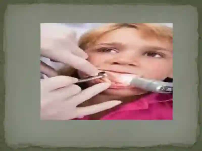 Zamonaviy stomatologiyada ish maydonini yuqori sifatli izolyatsiya 4