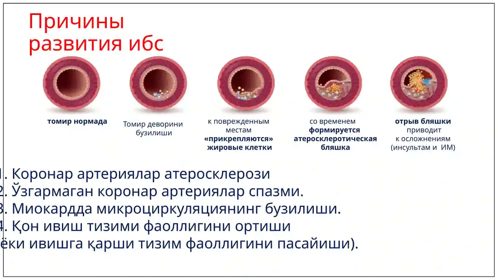 ЮРАК ИШЕМИККАСАЛЛИГИНИ ДАВОЛАШ САМАРАЛИ 4