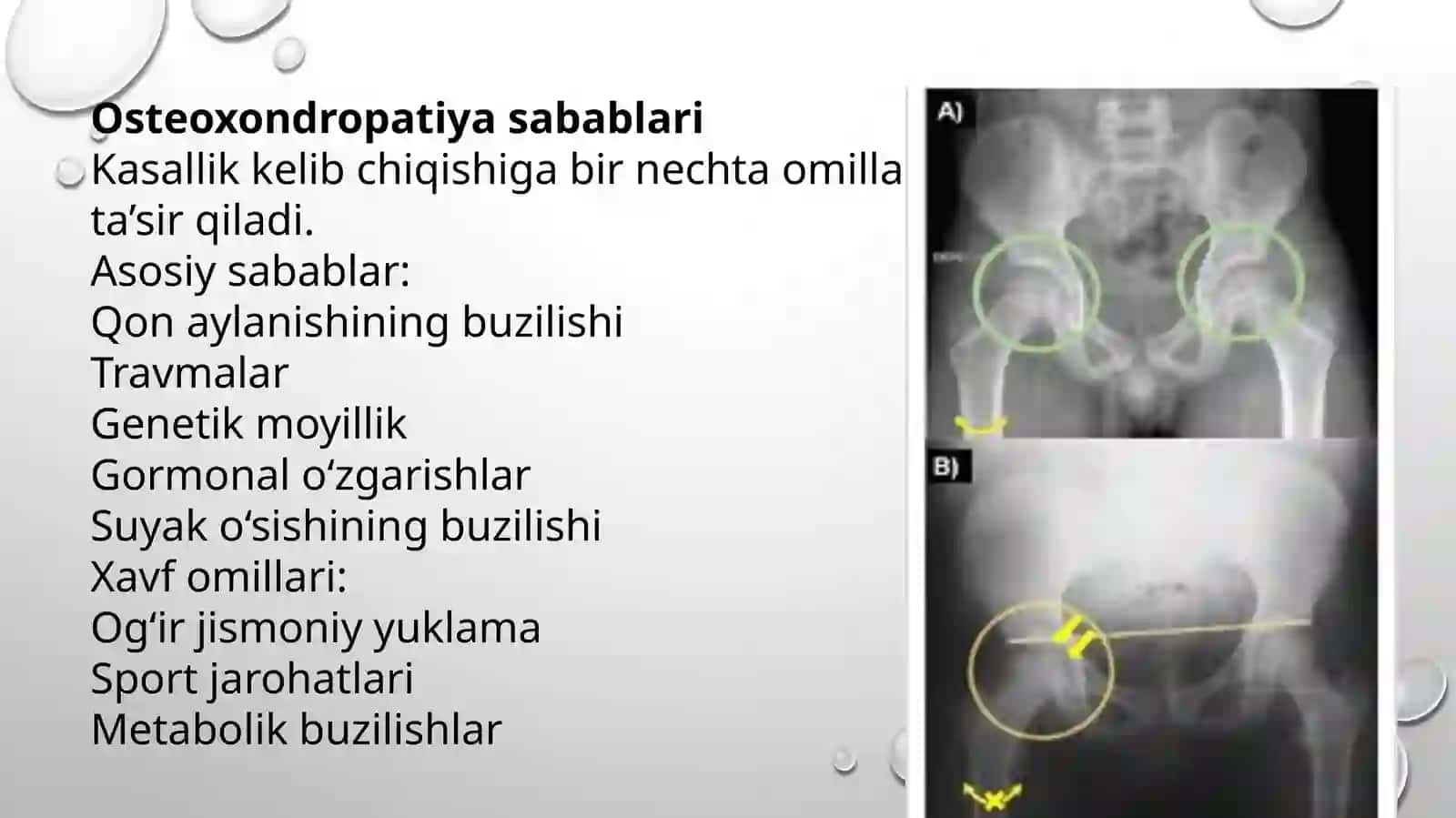 Osteoxondropatiyalar. Skolioz. 4