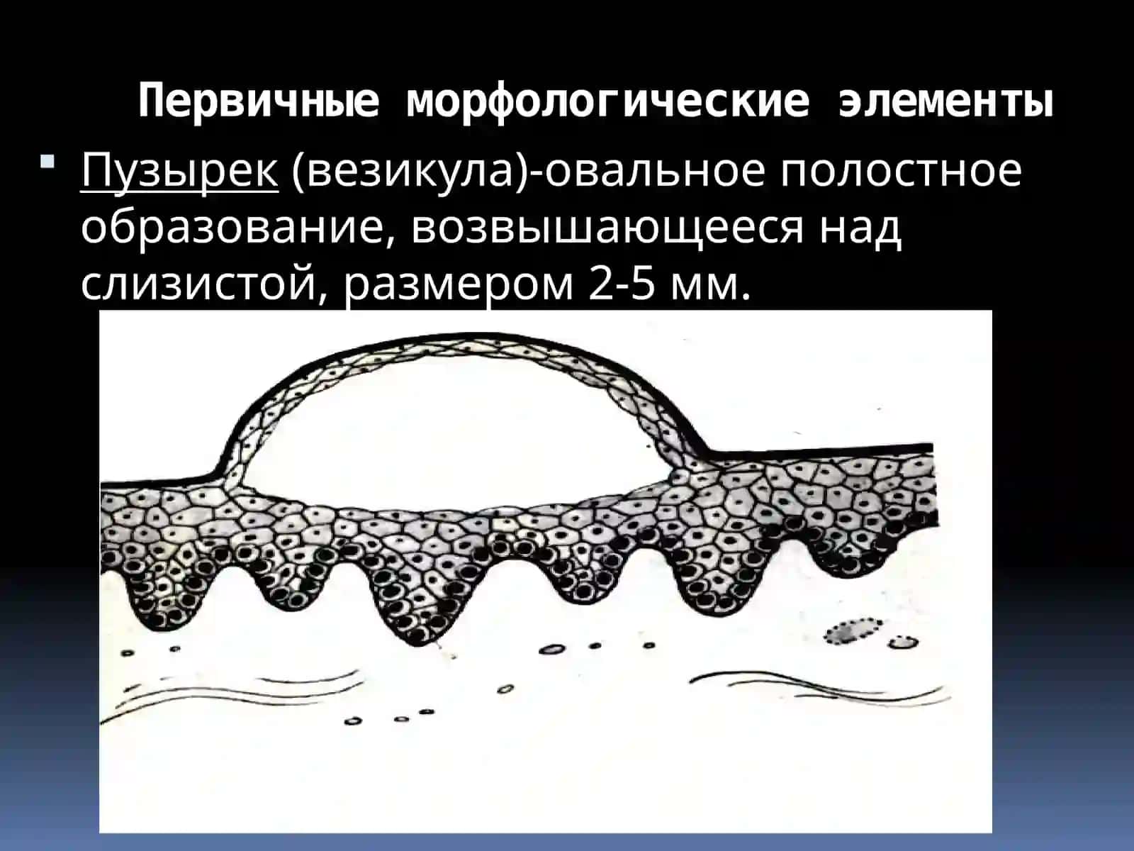 Заболевания слизистой оболочки и мягких тканей полости рта 4