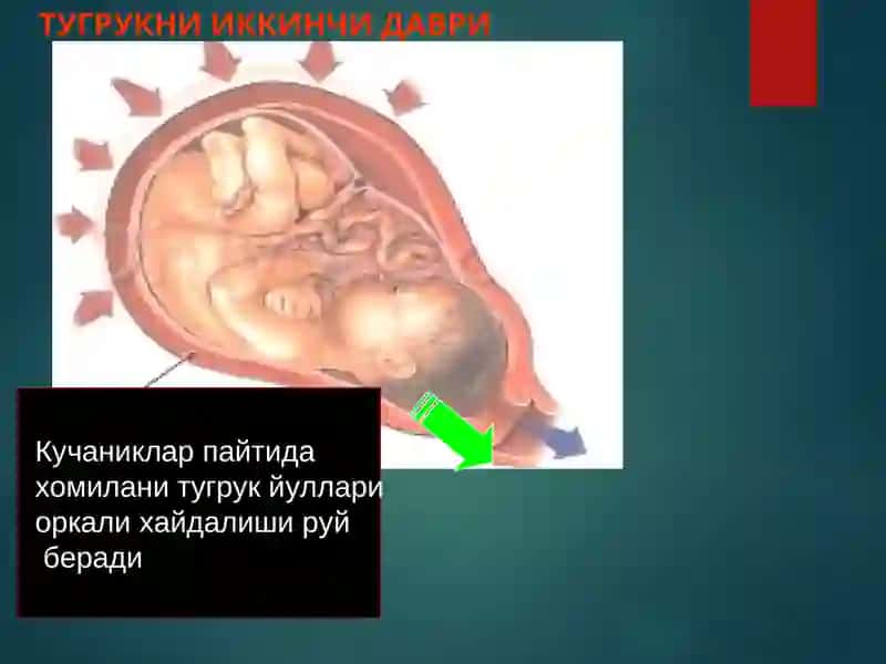 Коникарсиз туғруқ фаолияти 4
