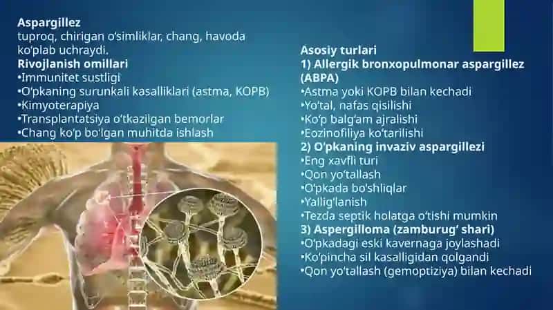 Zamburug' infeksiyalari(kandidoz va aspargillez) 4
