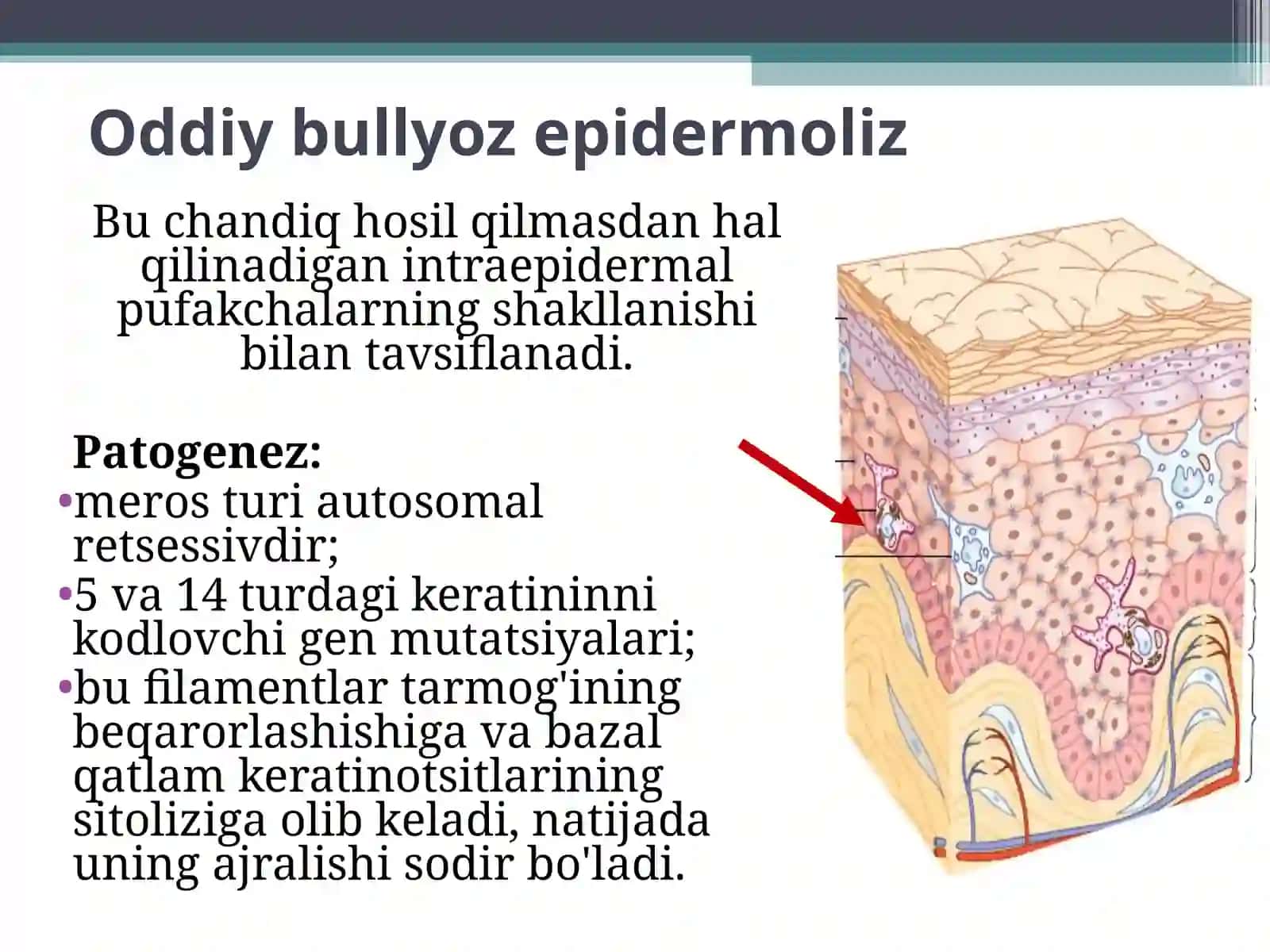 Bullyoz epidermoliz, Xeyli–Xeyli kasalligi 4