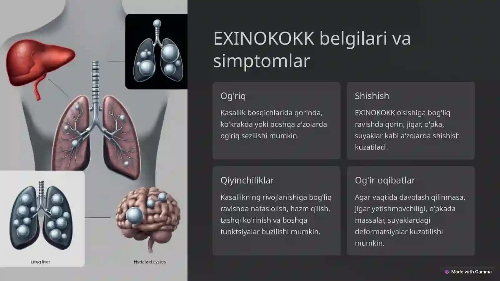 EXINOKOKK 4