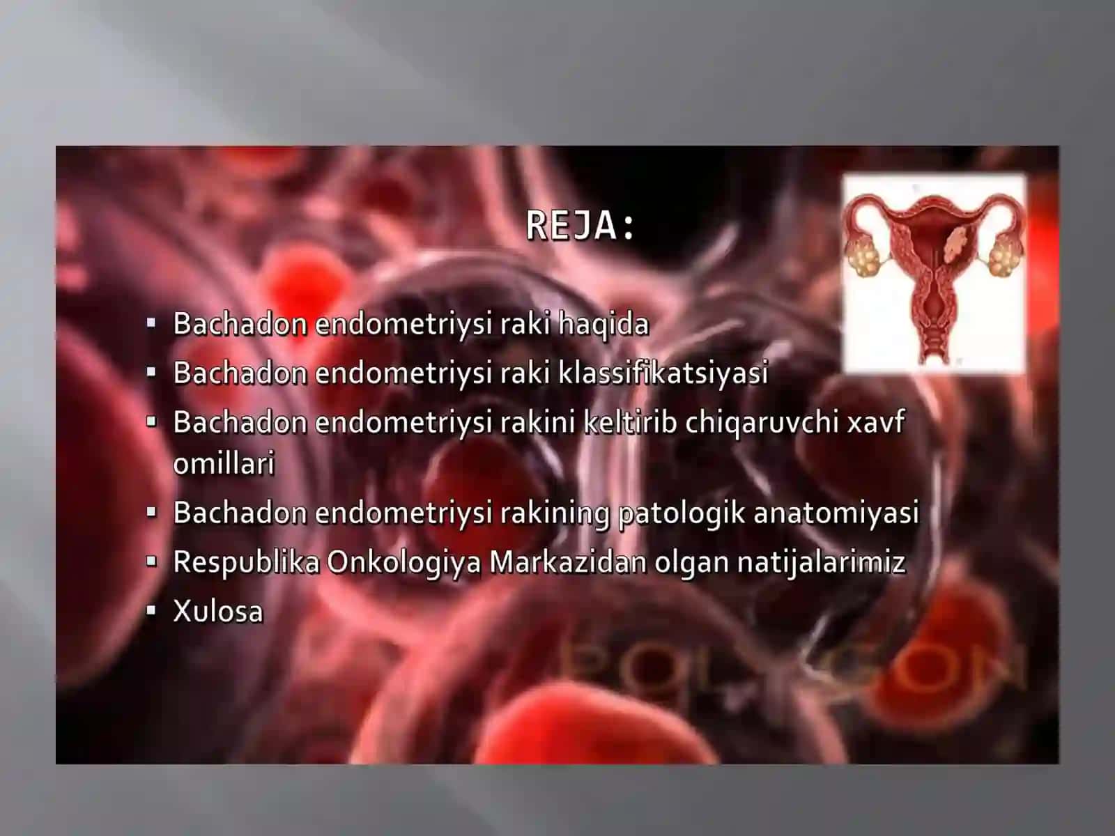 BACHADON ENDOMETRIYSI RAKI 4