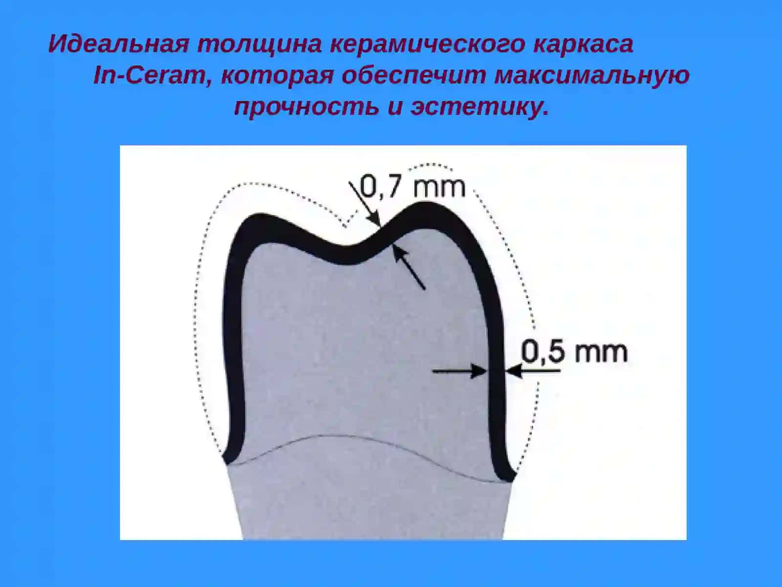 CAD/CAM технологии Cerec in Lab 4