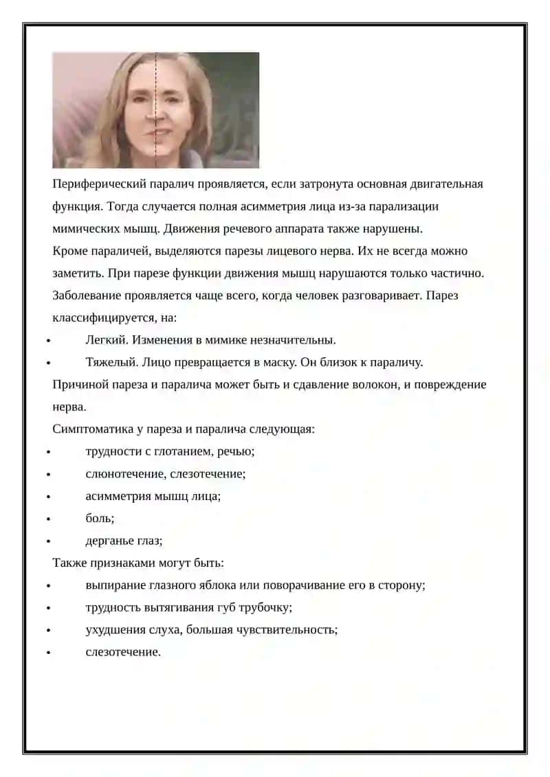 Анатомия и болезни лицевого нерва 4