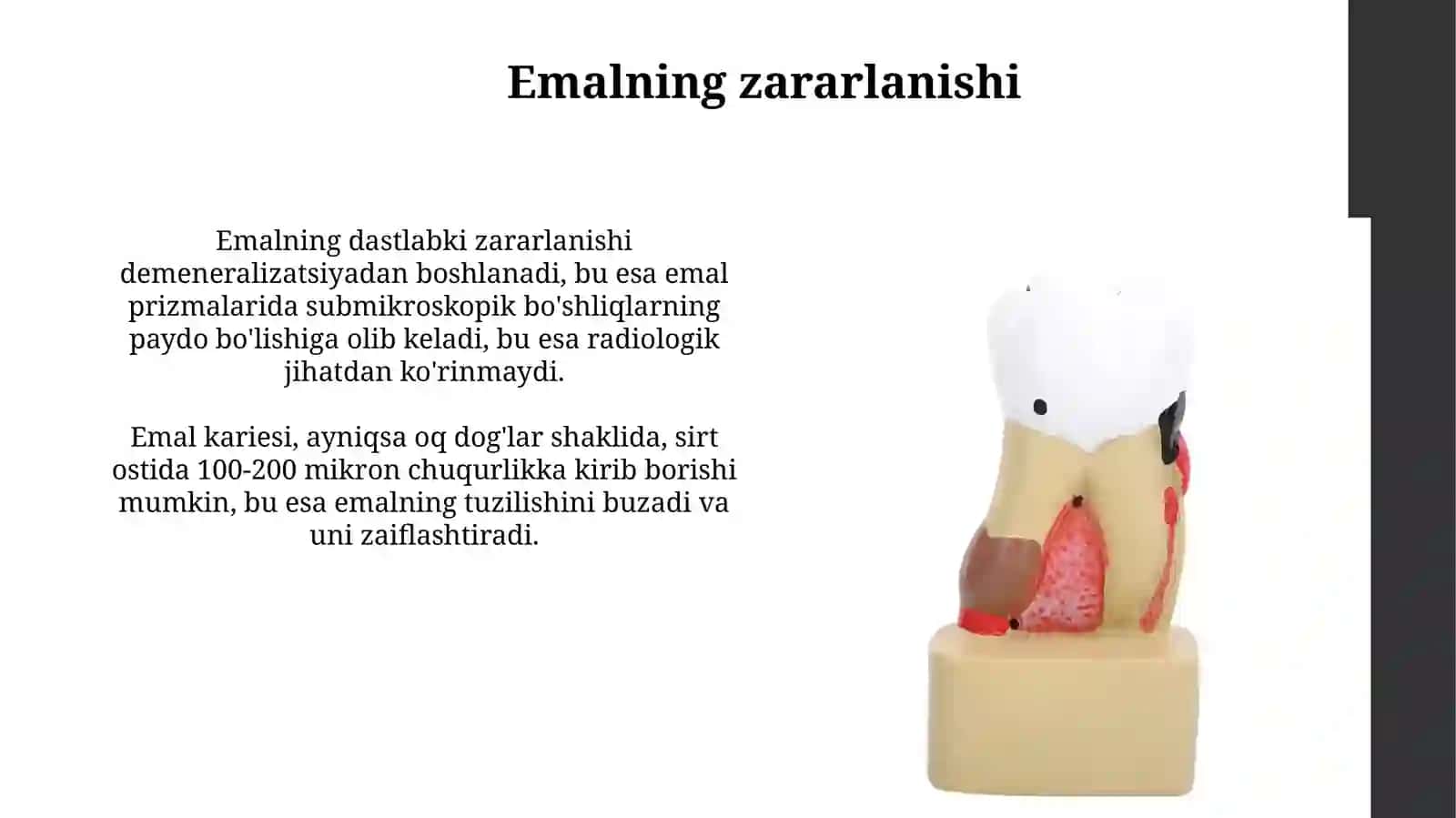 Kariesnipatalogikanatomiyasi 4