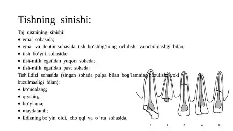 Tish chiqqandan keyin paydo bo’luvchi nokarioz kasalliklar. Tish jarohatlari. Etiologiya. Klinika. Diagnostika. Davolash 4