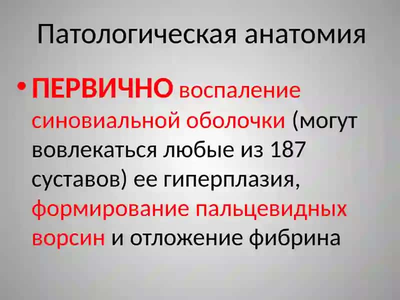 Ревматоидный артрит 4