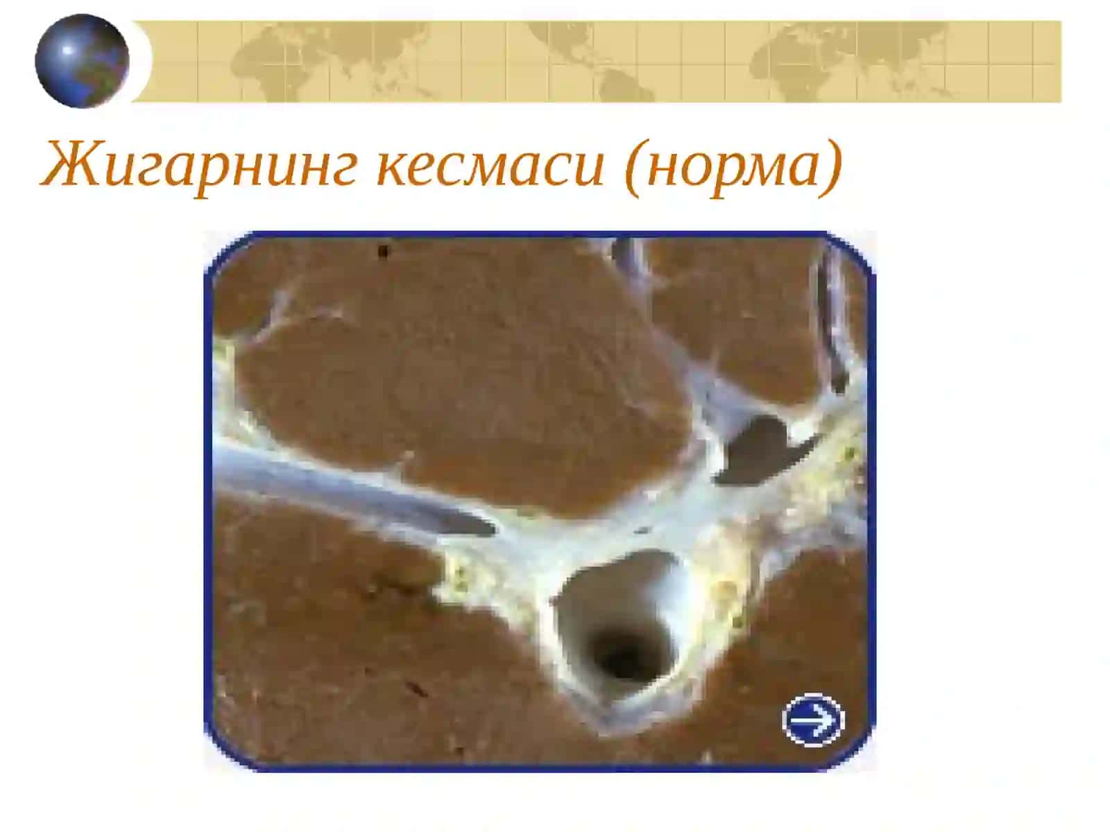 Сурункали гепатит 4