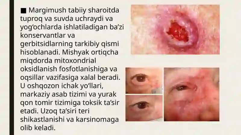 Kimyoviy va fizik agentlarning toksikligi. Oziqlanish
etishmovchiligi (avitaminoz). 4