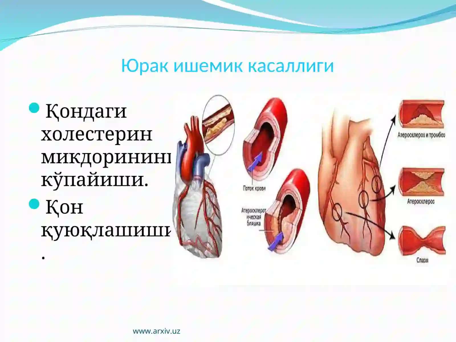 Уткир юрак-томир касаликларида 4