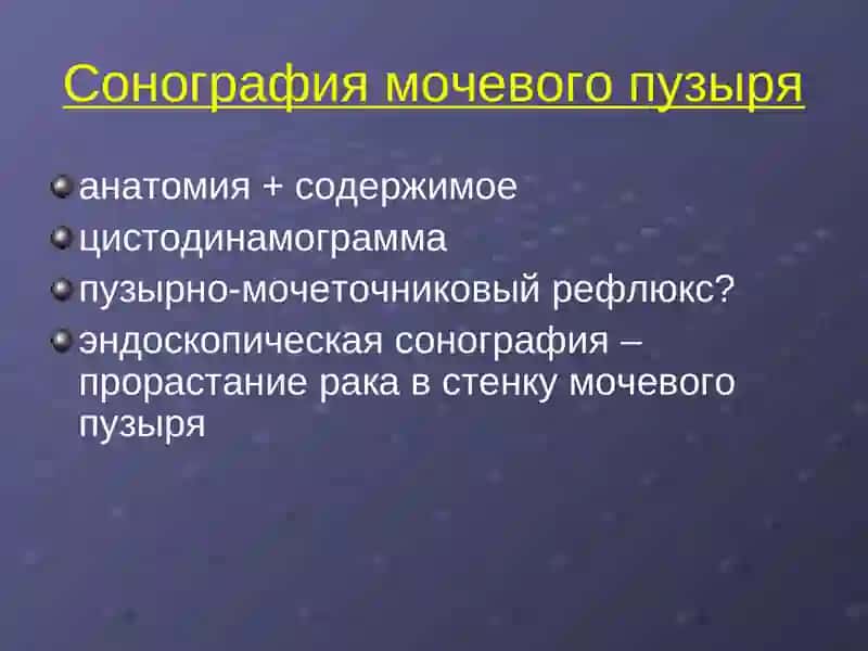 Лучевая диагностика заболеваний почек и мочевыводящих путей 4