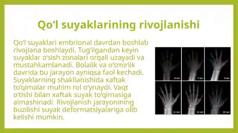 Qo'l suyaklarining rivojlanishiga ichki va tashqi faktorlarning ta'siri. 4