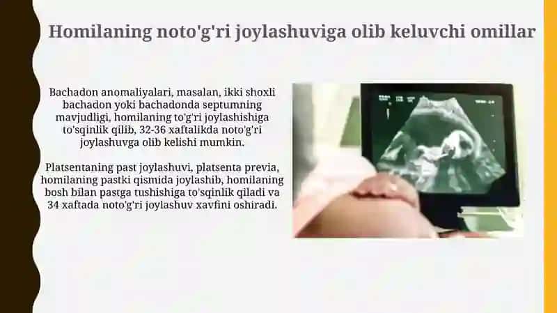 Homilaning Noto'g'ri Joylashuvi: Ta'rif va Turlari 4
